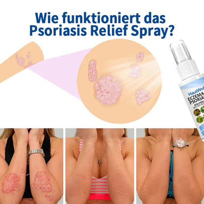 HautWohl™ Kräuter-Psoriasis-Linderungsspray
