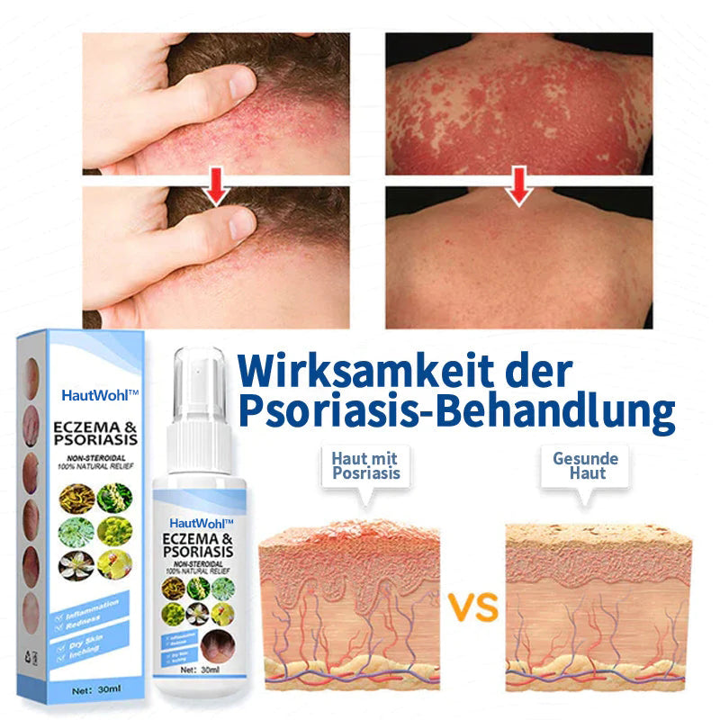 HautWohl™ Kräuter-Psoriasis-Linderungsspray