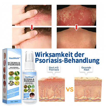 HautWohl™ Kräuter-Psoriasis-Linderungsspray