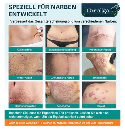 Oveallgo™ LUX Fortgeschrittenes Spray zur Narbenentfernung
