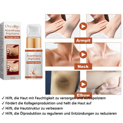 Oveallgo™ Acanthosis Nigricans Therapiespray