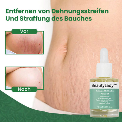 BeautyLady™ Kollagen Straffendes Körper Öl (Für Hals-Oberarm-Brust-Bauch-Gesäß-Oberschenkel und mehr)