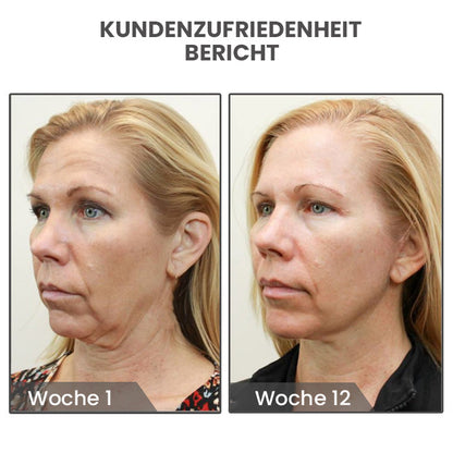 KlassischePlus MagneTech Akupunktur-Ohrringe