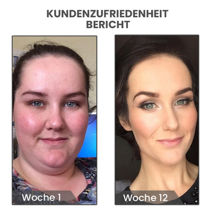 KlassischePRO MagneTech Akupunktur-Ohrringe