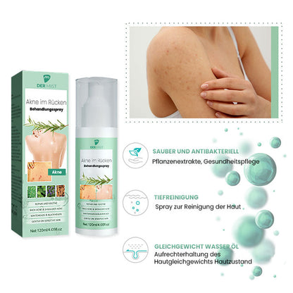 DerMist Rücken Akne Behandlung Kräuterspray