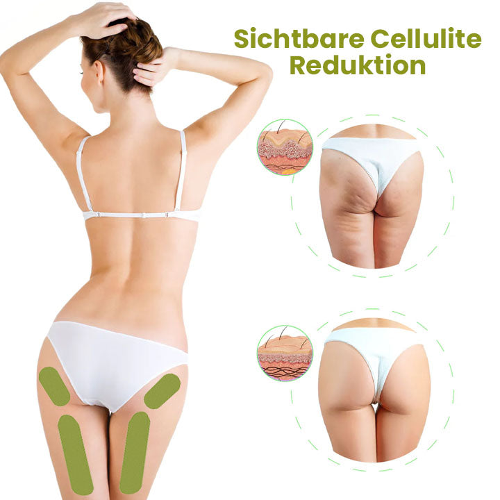 Oveallgo™ HerbalFirm PURE Wunder Cellulite Reduktion Pflaster