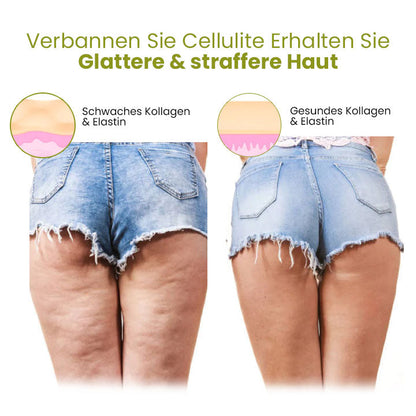 Oveallgo™ HerbalFirm PURE Wunder Cellulite Reduktion Pflaster