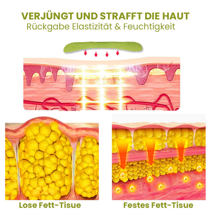 Oveallgo™ HerbalFirm PURE Wunder Cellulite Reduktion Pflaster