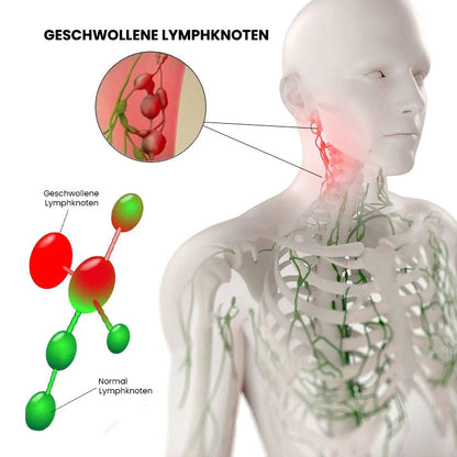 LymphePlus Lymphdrainagen Ingweröl