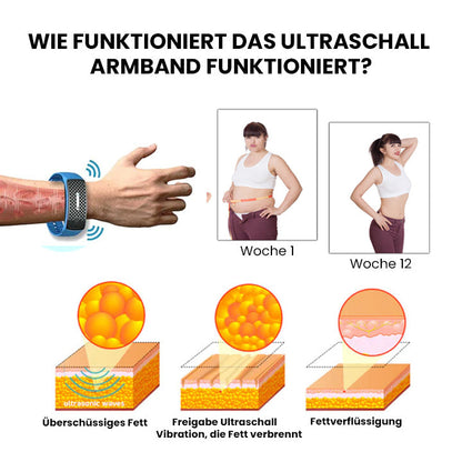 Oveallgo™ MatteoCURE Ultraschall Körperform Armband