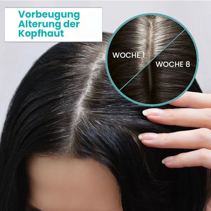 Oveallgo™ ScalpReboost NMN Haarwuchs Roller