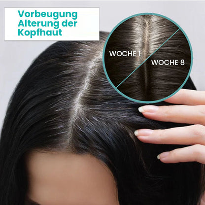 Oveallgo™ ScalpReboost NMN Haarwuchs Roller