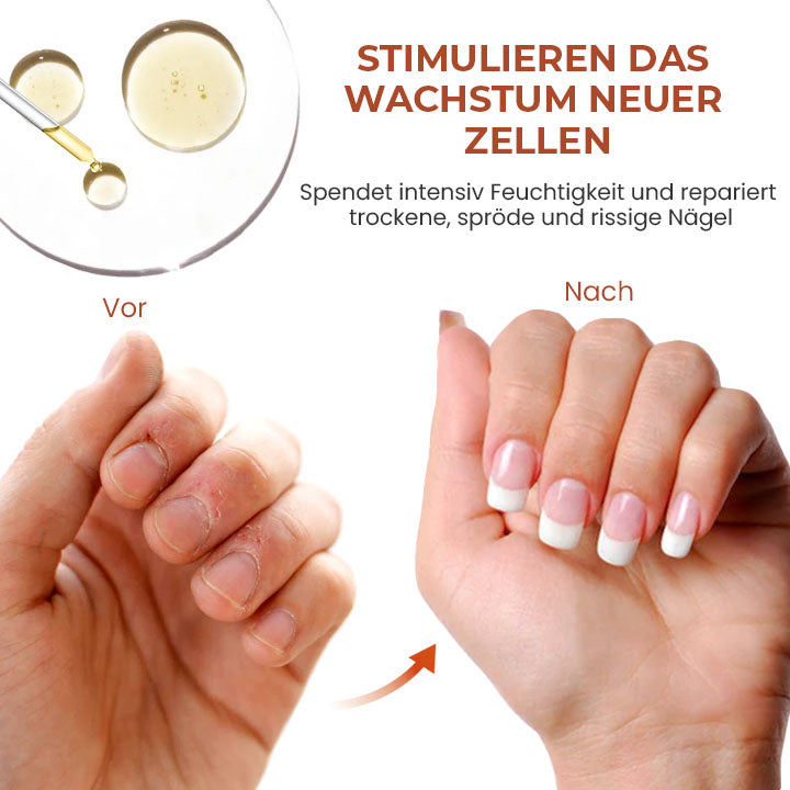 Oveallgo™ 7 Tage Profi Maximale Stärke Nagel-Reparatur-Serum