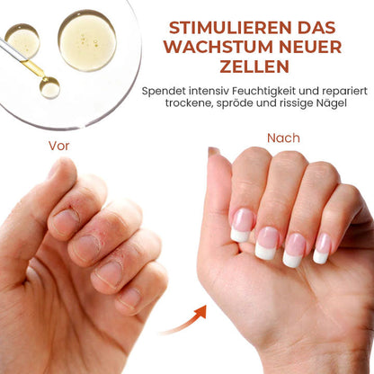 Oveallgo™ 7 Tage Profi Maximale Stärke Nagel-Reparatur-Serum