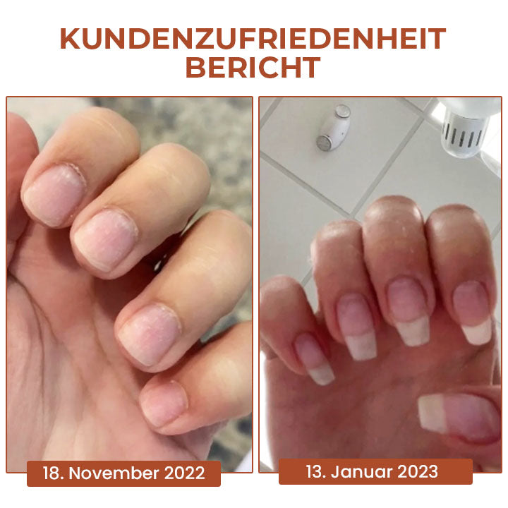 Oveallgo™ 7 Tage LUX Maximale Stärke Nagel-Reparatur-Serum