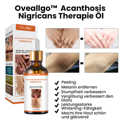 Oveallgo™ Akanthose LUX Nigricans Therapieöl