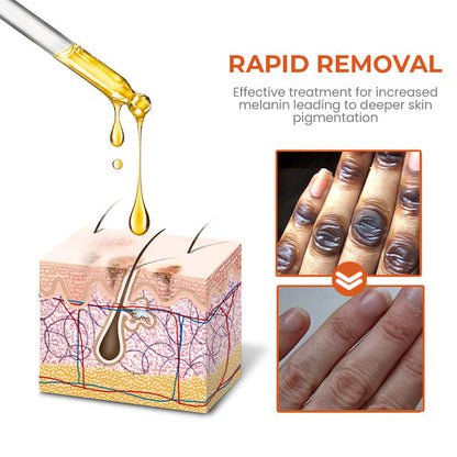 Oveallgo™ Akanthose LUX Nigricans Therapieöl