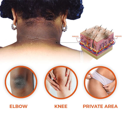 Oveallgo™ Akanthose LUX Nigricans Therapieöl