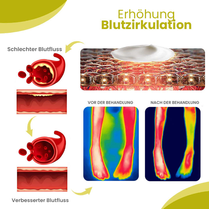 Oveallgo™ AnschwellenAuswärts PURI Bein Comfort Ingwer-Salbe