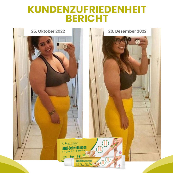 Oveallgo™ AnschwellenAuswärts PURI Bein Comfort Ingwer-Salbe