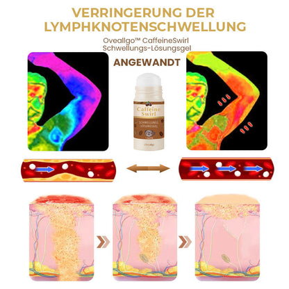 Oveallgo™ CaffeineSwirl Ultimativ Schwellungs-Lösungsgel