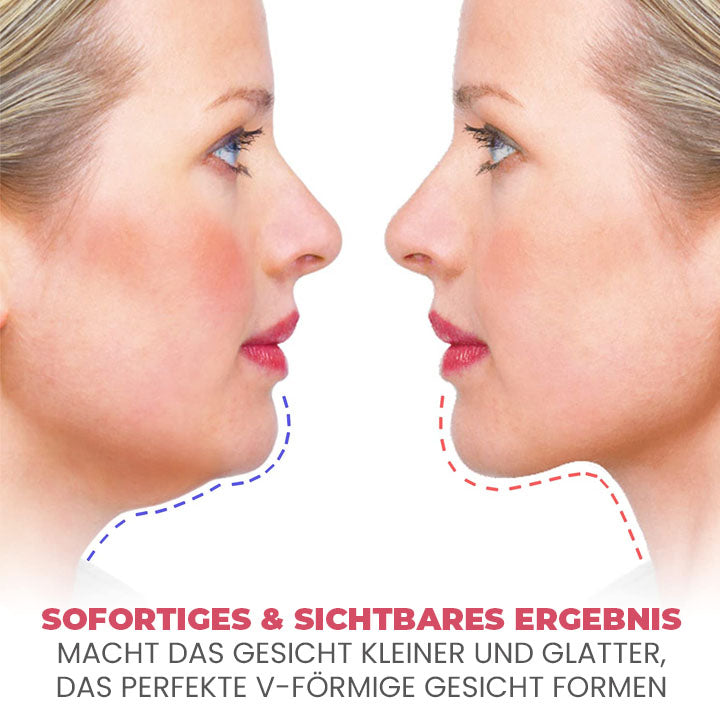 Oveallgo™ PRO Doppelkinn-Entfernung V-Gesichts-Saugtrainer