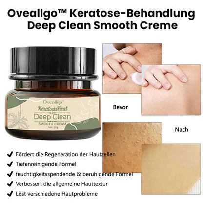 Oveallgo™ Keratose-Behandlung Deep Clean Smooth Creme