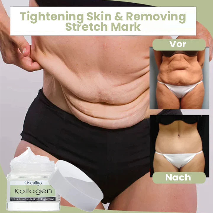 Oveallgo™ Kollagen Boost Schnell Straffende&Lockernde Creme
