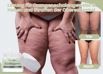 Oveallgo™ Kollagen Boost Schnell Straffende&Lockernde Creme
