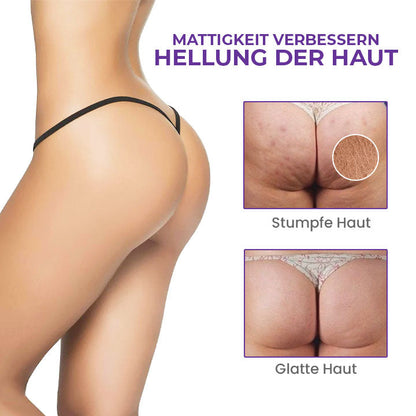 Oveallgo™ LIFT Lumina Creme