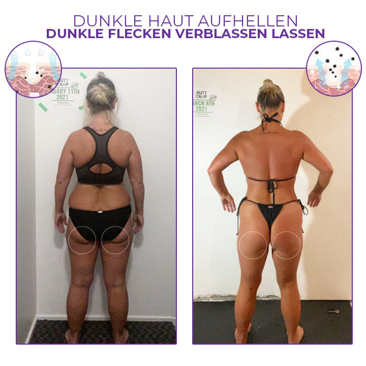 Oveallgo™ LIFT PRO Lumina Creme