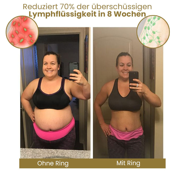 Oveallgo™ Meliora Klassic Magnetit Kreuz und Quer Lymphvital Ring