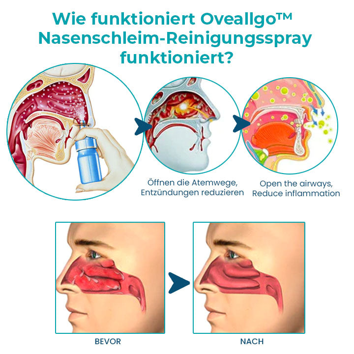 Oveallgo™ Profi Nasenschleim-Reinigungsspray