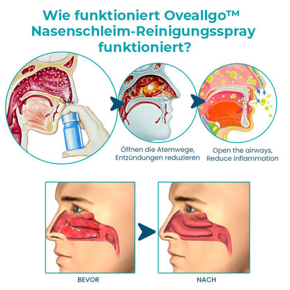 Oveallgo™ Profi Nasenschleim-Reinigungsspray