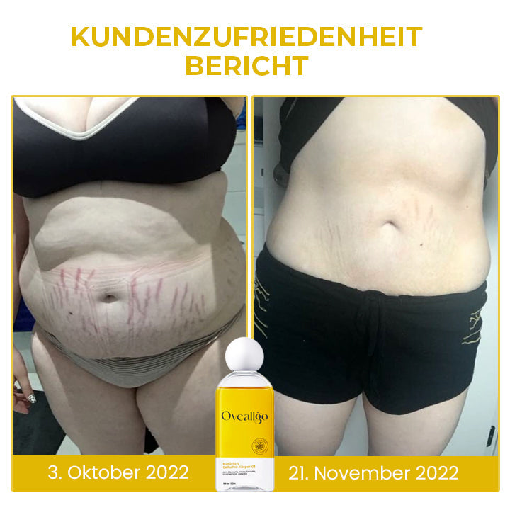 Oveallgo™ Natürliches CelluPro-Körperöl
