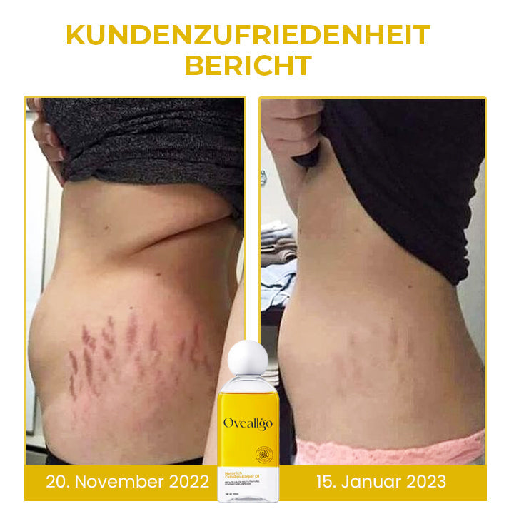 Oveallgo™ Natürliches CelluPro-Körperöl