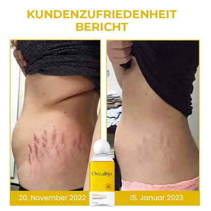 Oveallgo™ Natürliches CelluPro-Körperöl
