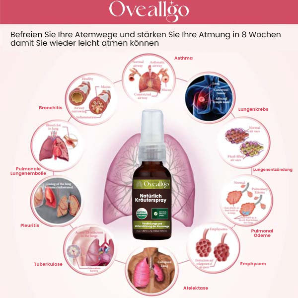 Oveallgo™ Natürliches Kräuterspray zur Unterstützung von Lunge und Atemwegen