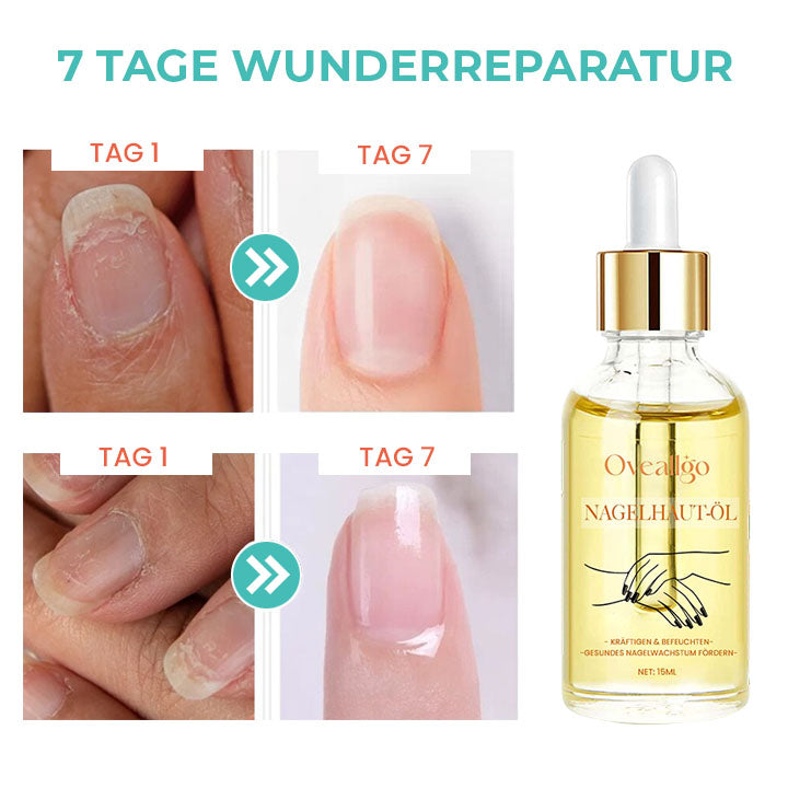 Oveallgo™ Reichhaltiges Vitamin Nagelstärkendes Nagelhautöl