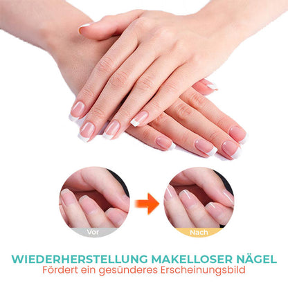 Oveallgo™ Reichhaltiges Vitamin Nagelstärkendes Nagelhautöl