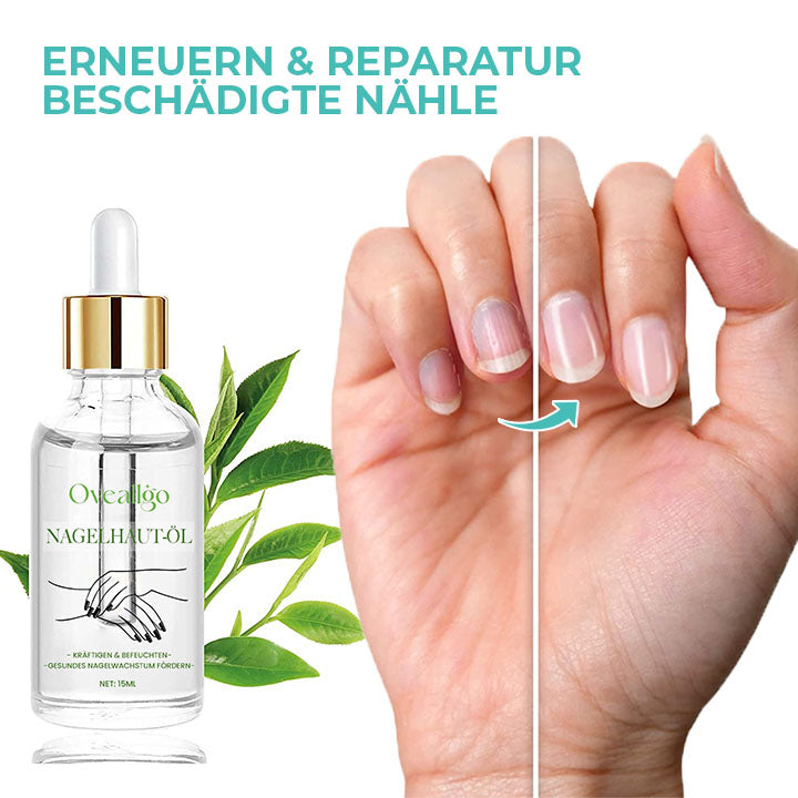 Oveallgo™ Reichhaltiges Vitamin Nagelstärkendes Nagelhautöl
