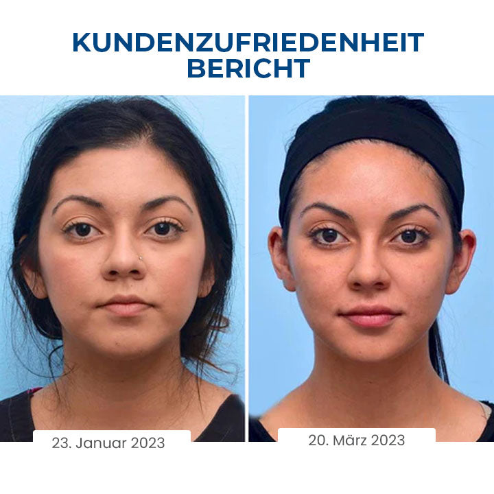 Oveallgo™ SleepBeauty PRO Gesichtsbildhauer