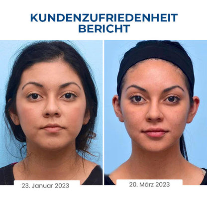 Oveallgo™ SleepBeauty PRO Gesichtsbildhauer