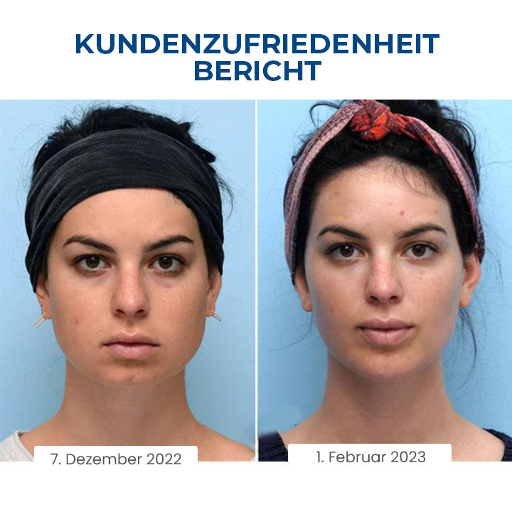 Oveallgo™ SleepBeauty Wunder Gesichtsbildhauer