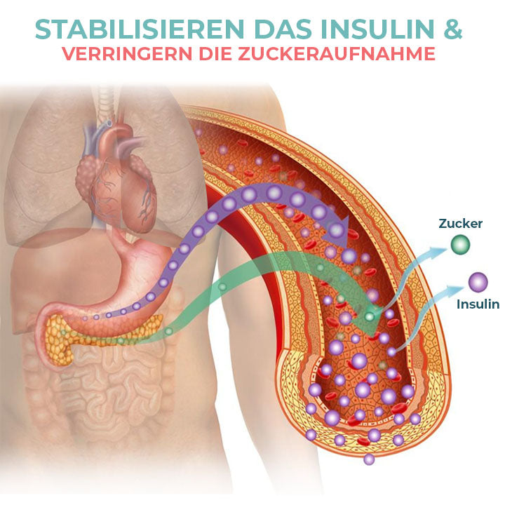 Oveallgo™ SugarFixedX Ultraschall Verflüssigungs Handschlaufe