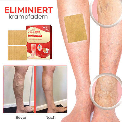 Oveallgo™ VeinLessX Kräuterpflaster mit sofortiger Linderung