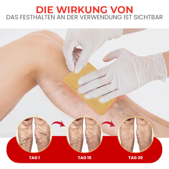Oveallgo™ VeinLessX Kräuterpflaster mit sofortiger Linderung
