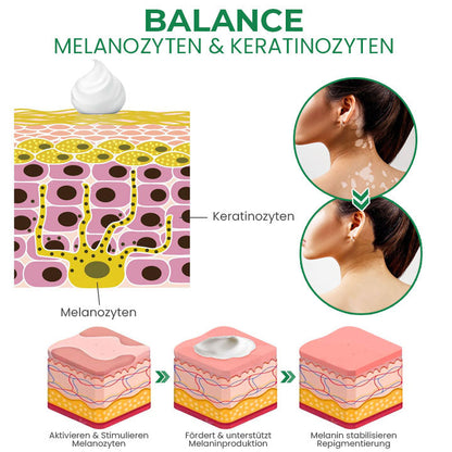 Oveallgo™ VitiligoFix X Revitalisierendes Elixier