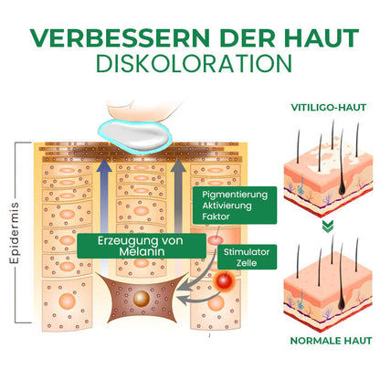 Oveallgo™ PRO VitiligoFix Revitalisierendes Elixier