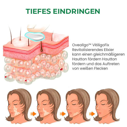 Oveallgo™ VitiligoFix X Revitalisierendes Elixier